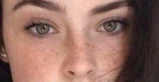 Freckles Reference